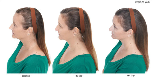 How to Photograph Your Hair Progress (and Spot Early Results)