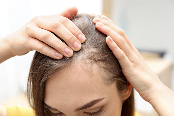 A woman holding on her scalp showcasing a balding spot