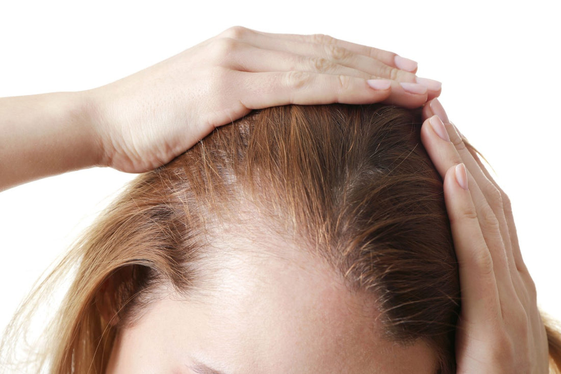 A woman holding her scalp revealing a thinning hair line