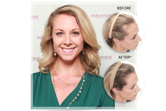 A woman in green clothes smiling with before and after image of her scalp 