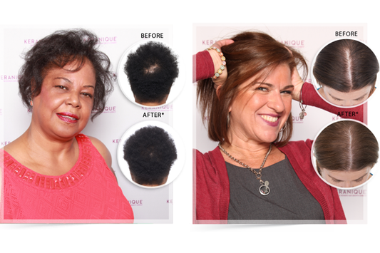 two women pictured with their hair before and after using keranique