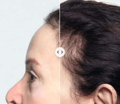 The Thicker Fuller Hair Deluxe System